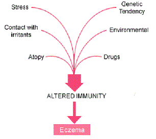 Causes of Eczema