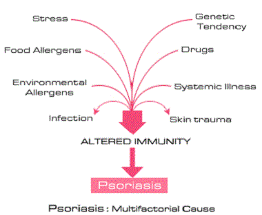 Psoriasis Causes