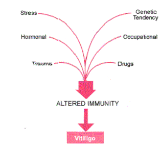 Causes of Vitiligo