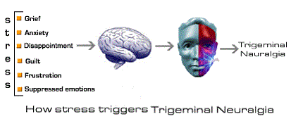 how stress triggers trigeminal neuralgia