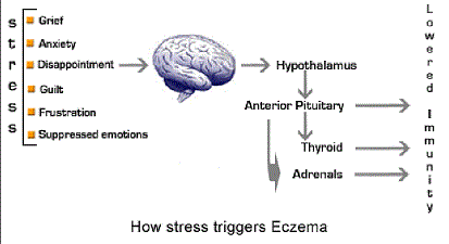 Stress and eczema