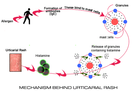 Urticaria rash mechanism